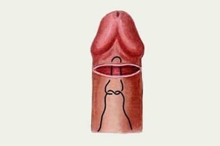 πώς να αυξήσει το πέος